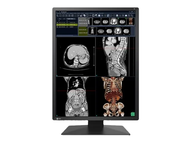 EIZO RadiForce RX270