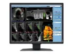 EIZO RadiForce MX217-HB
