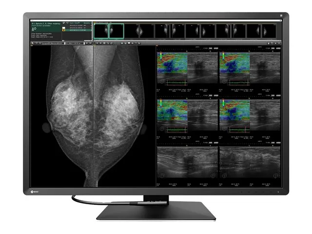 EIZO RadiForce RX1270