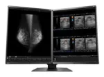 EIZO RadiForce RX560-MD