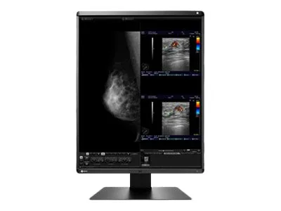 EIZO RadiForce RX560